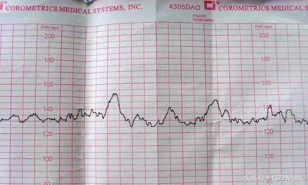 揭秘胎心频率，四个月胎儿心跳率与性别之谜揭晓