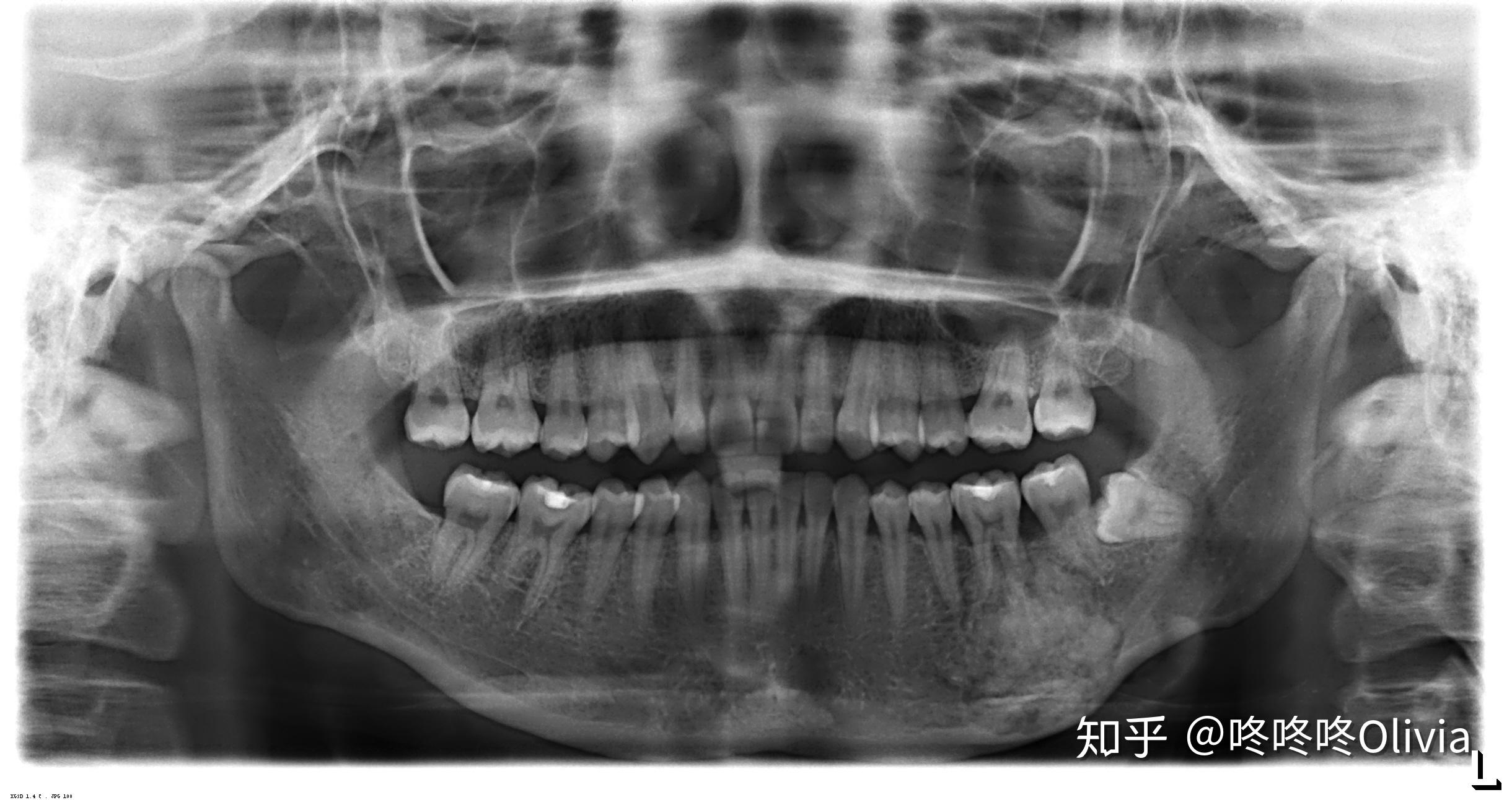 广东省口腔拍牙片的现状与发展